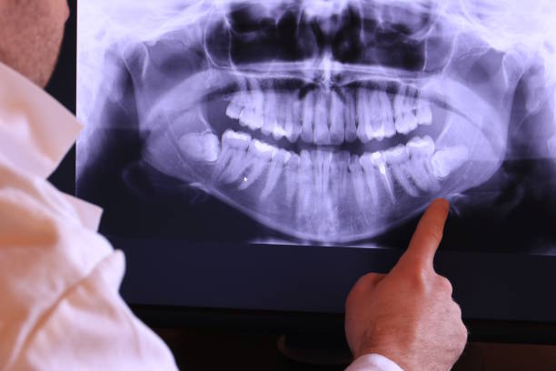 Best Walk-In Emergency Dentist in Mount Morris, IL