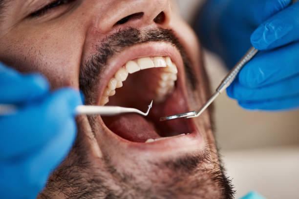 Best Emergency Tooth Extraction in Mount Morris, IL