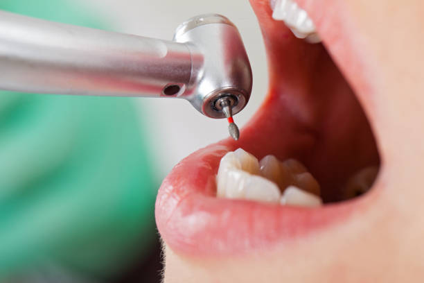Best Walk-In Emergency Dentist in Mount Morris, IL